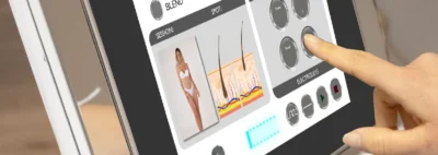 Інтерфейс електроепілятора з вибором фототипу